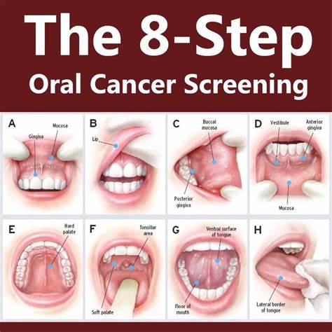 Screening Malattie Neoplastiche del Cavo Orale